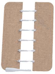 S-Sustener surgical skin closure